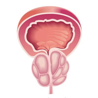 درمان پروستات